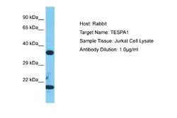 TESPA1 Rabbit anti-Human, Polyclonal, Novus Biologicals 0.1 mL | Buy Online | Novus Biologicals | Fisher Scientific